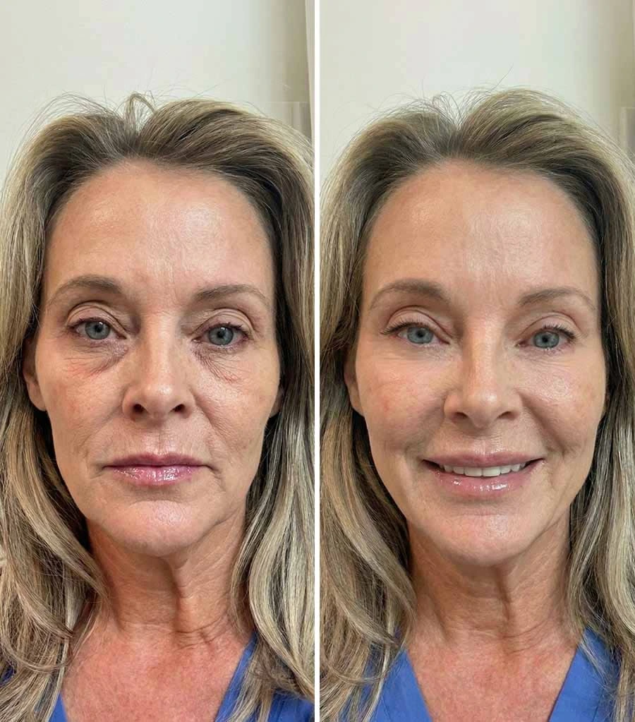 Depoimento de Teresa, 53 anos