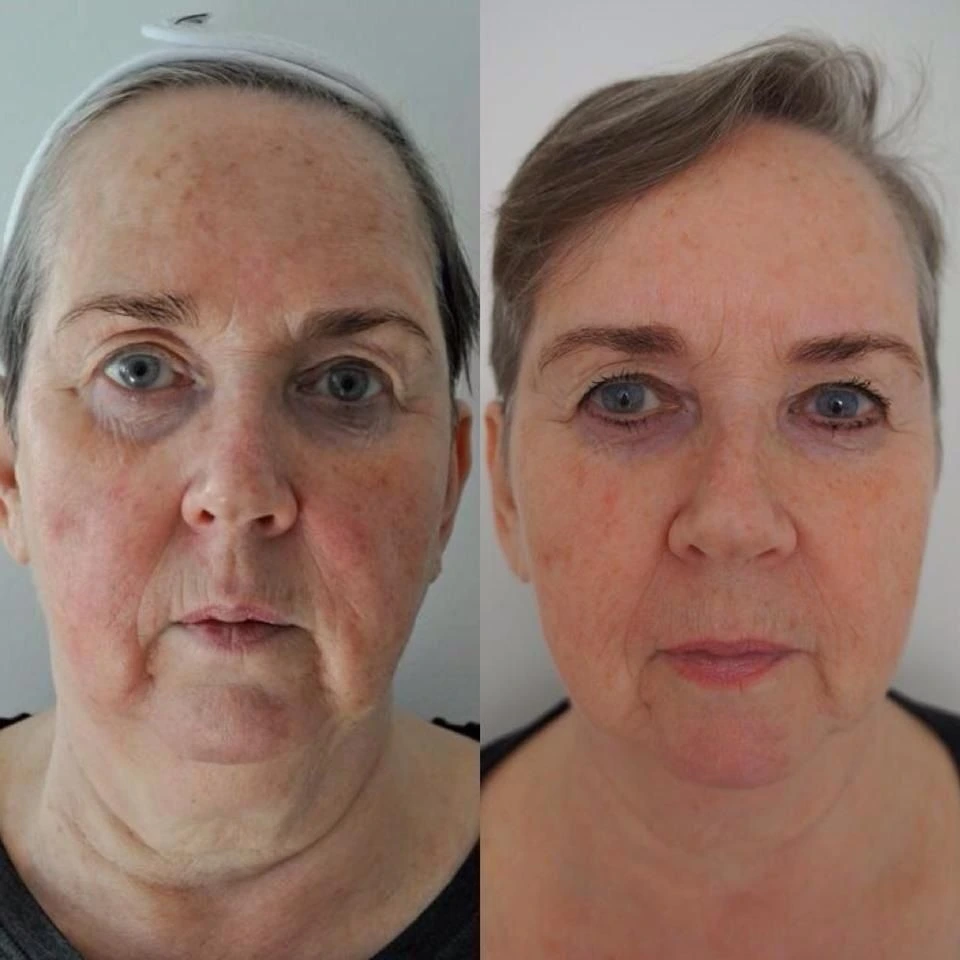 Depoimento de Helena, 58 anos
